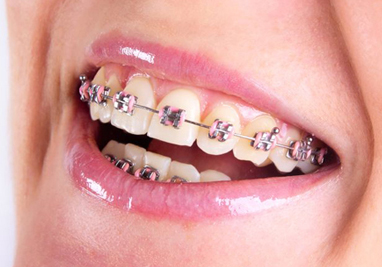 Hinesly Orthodontics