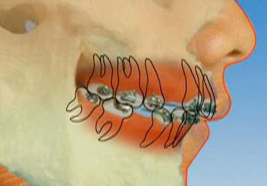 Hinesly Orthodontics